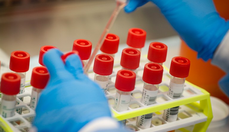 FDA approves coronavirus test that gives results in less than an hour