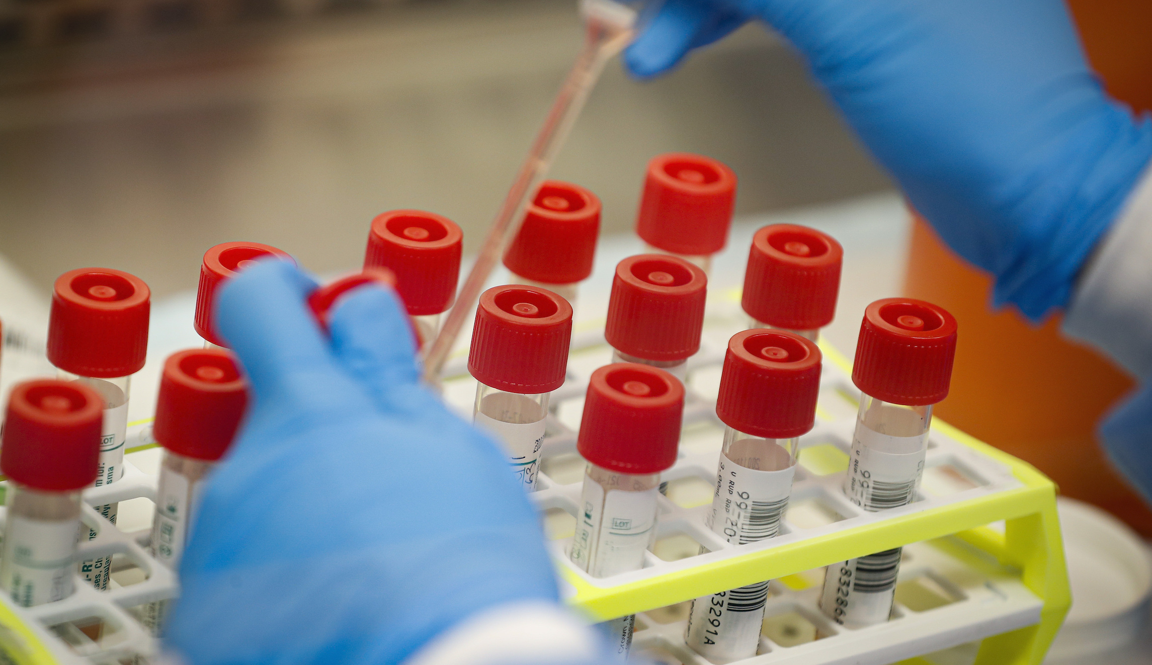 COVID-19 shows that experts don’t know everything