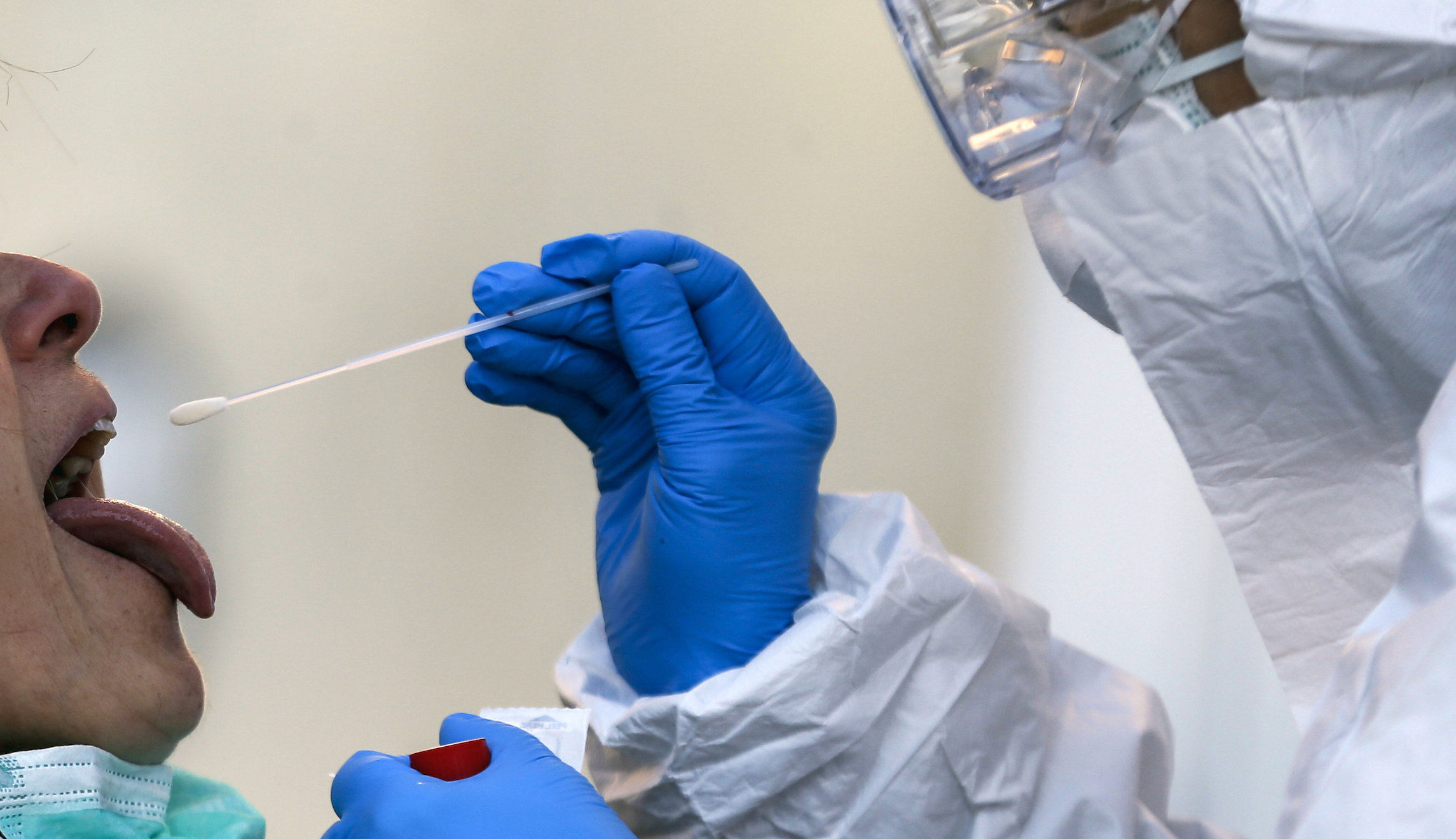 Health experts believe 1 in 3 infected patients getting negative coronavirus test results