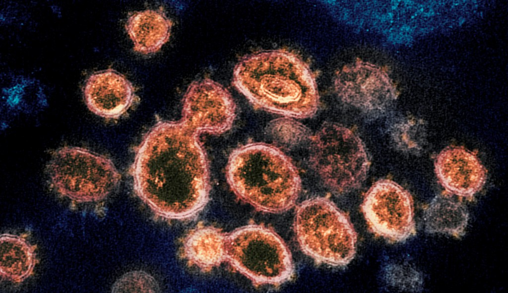 Vaccine-resistant lambda variant is in the US