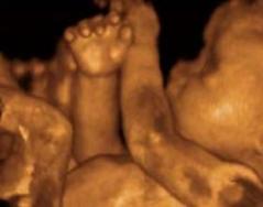 Philadelphia Abortionist Charged for Killing 7 Babies After They Were Born