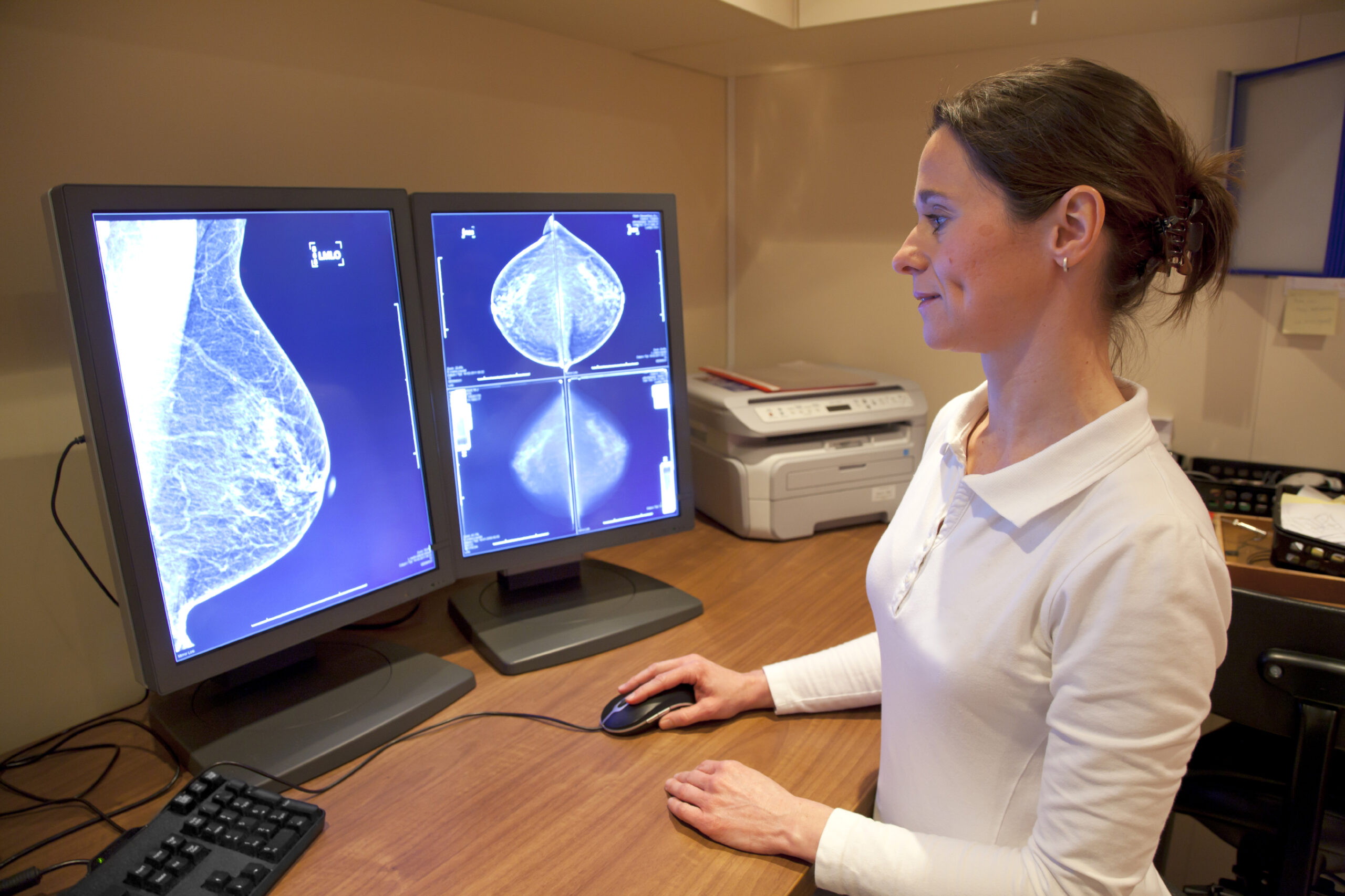 Air pollution linked to higher rates of breast cancer