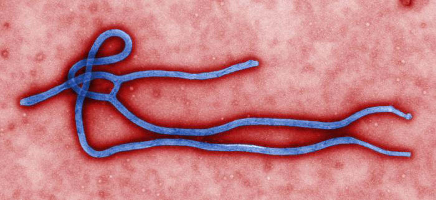 Sierra Leone cyclist cleared of Ebola at Glasgow