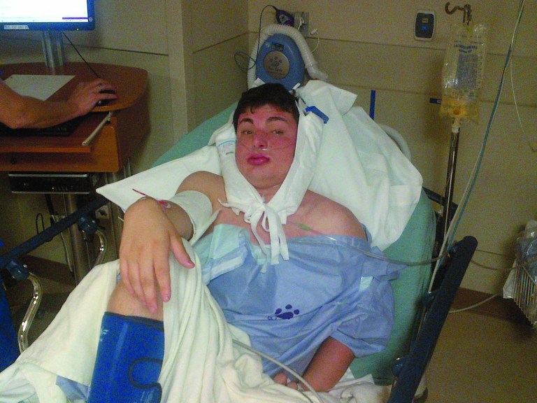 In this undated photo provided by Bruce Tennen, Zachary Tennen, a 19-year-old Michigan State University sophomore, is shown. Police say an attack on the Michigan State University student at an off-campus party is not being investigated as a hate crime. Tennen told East Lansing, Mich., police his attackers asked if he was Jewish, and when he responded 