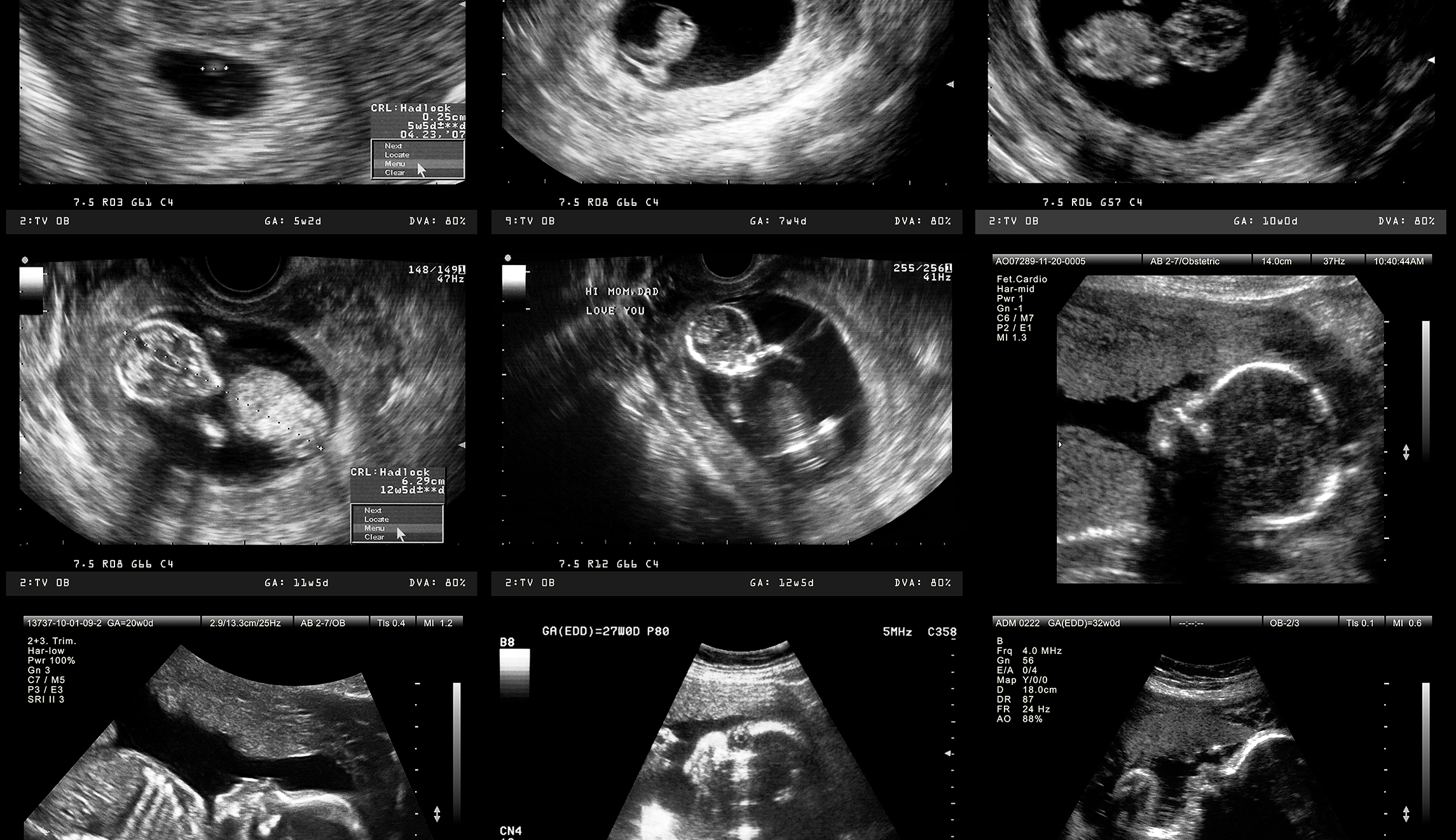 Science tells us when life begins. Why isn’t it taught in the classroom?