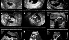 Science tells us when life begins. Why isn’t it taught in the classroom?