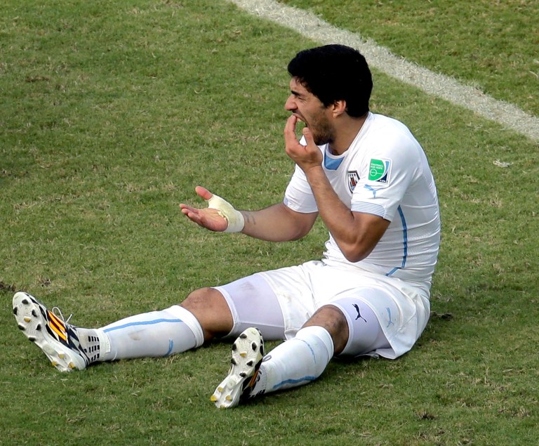 Uruguay's Luis Suarez holds his teeth after running into Italy's Giorgio Chiellini's shoulder during the group D World Cup soccer match between Italy and Uruguay at the Arena das Dunas in Natal, Brazil, Tuesday, June 24, 2014. (AP Photo/Hassan Ammar)