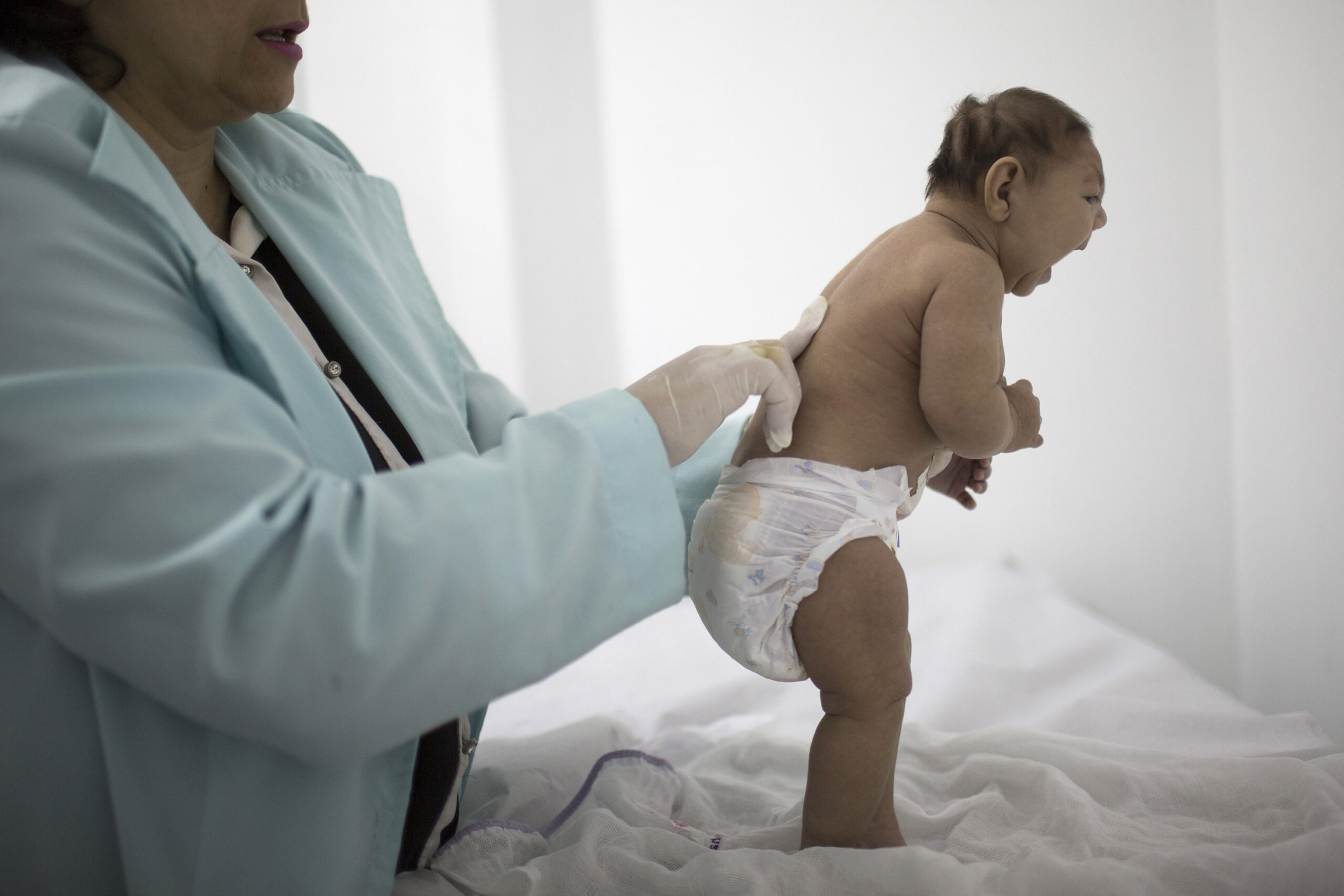 CDC: Zika virus causes birth defects