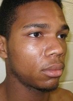 Accused hatchet man enlisted help to dispose of body