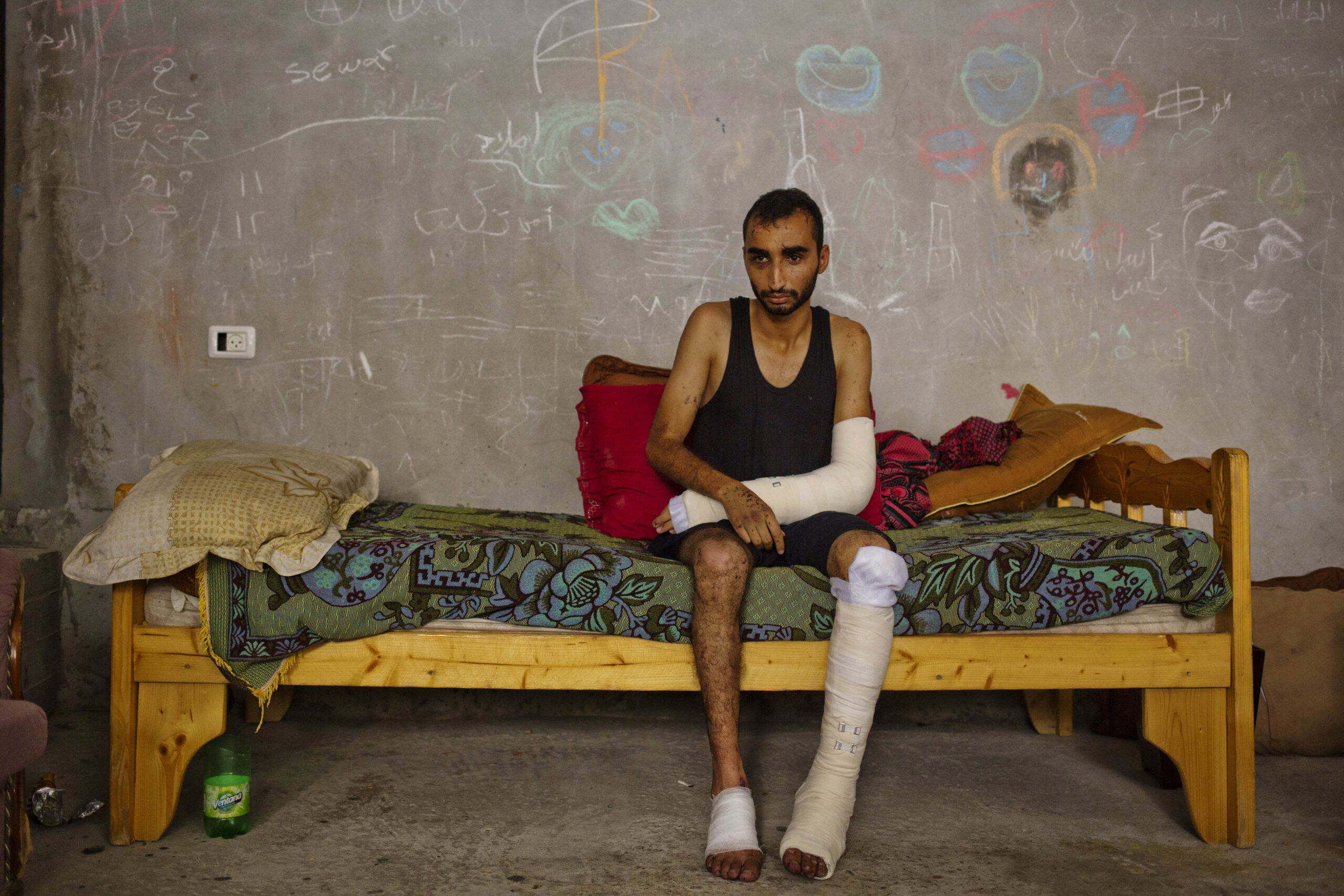 Gaza’s wounded: Living reminder of ravages of war