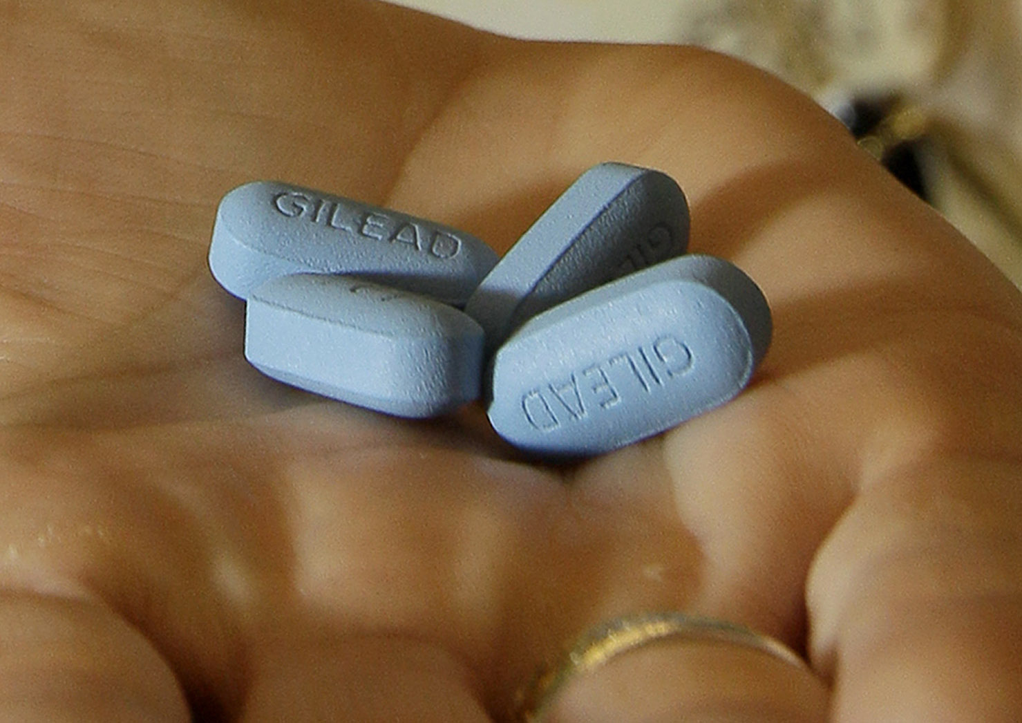 Obamacare plans offer limited access to HIV drugs
