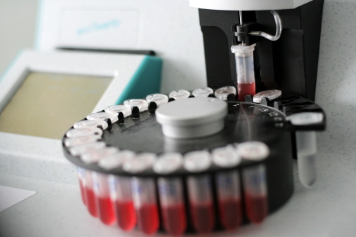 Report: Fewer in D.C. dying from AIDS, HIV