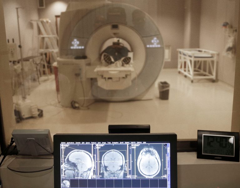 Report shows that the NFL funded part of a brain injury study at NIH as part of a $30 million donation. (AP Photo/Paul Sancya)