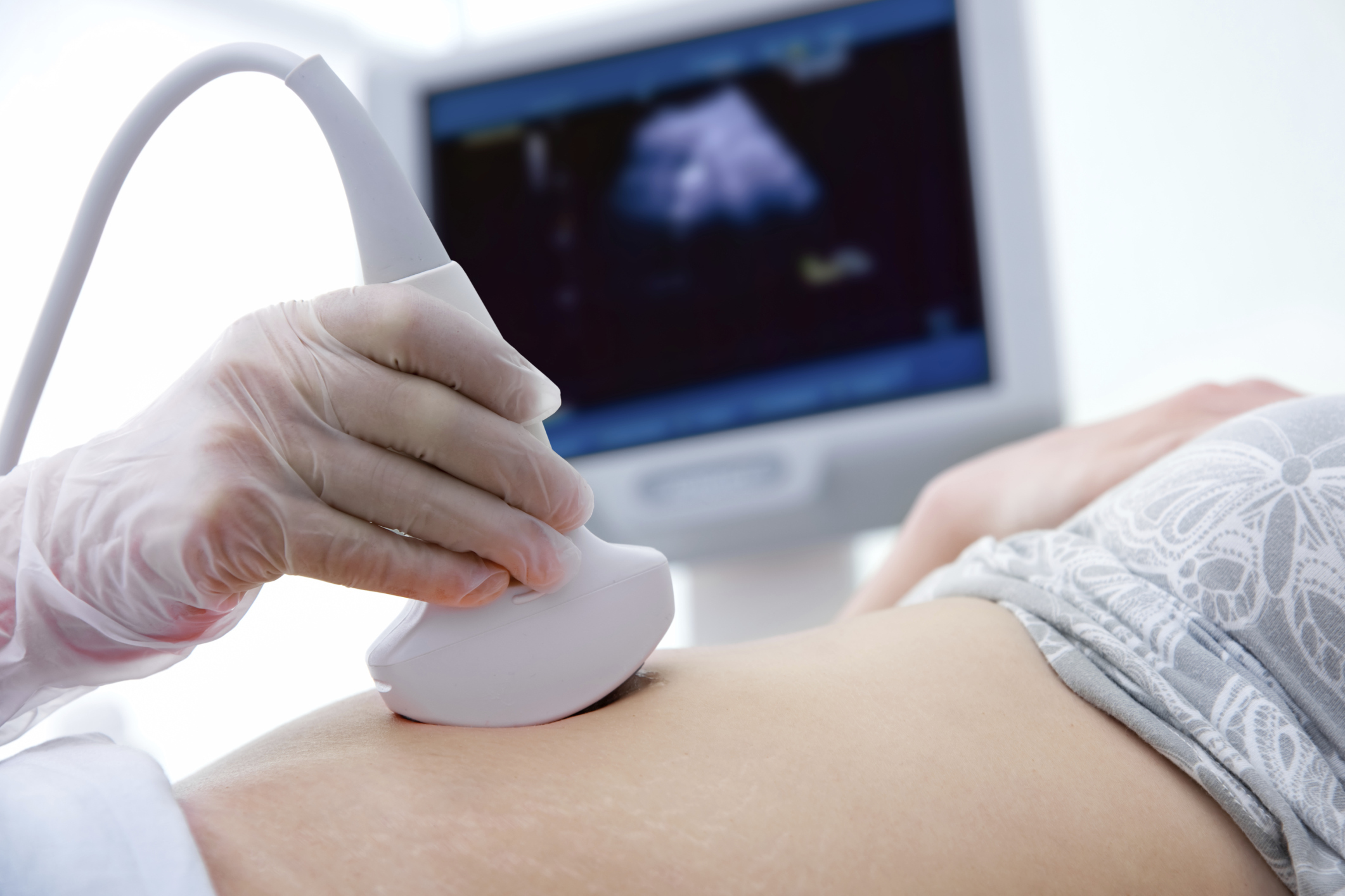 Coming next under Obamacare is the abortion mandate