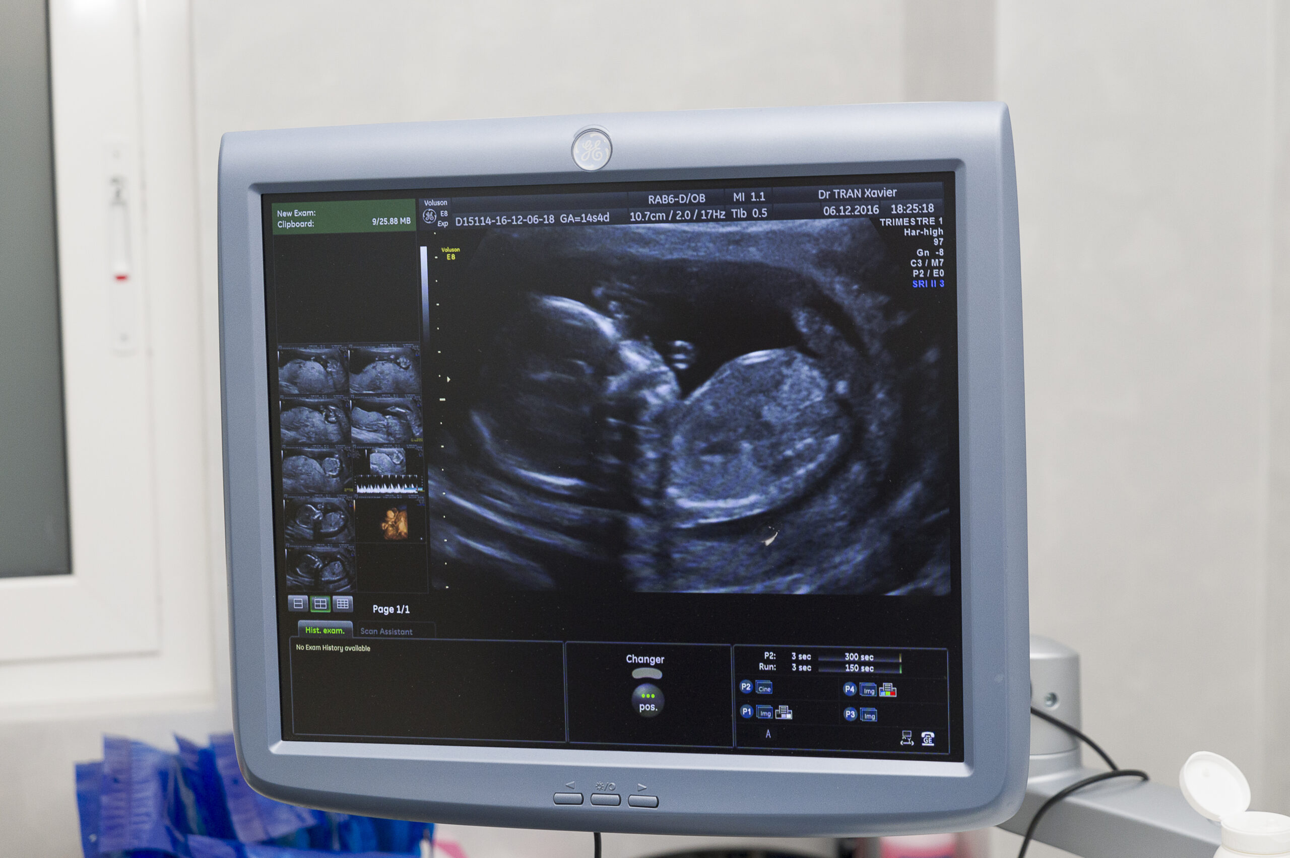Scott Walker’s Dem Opponent: Tax Dollars Should Pay for Abortions Just Like They Pay for Tonsillectomies