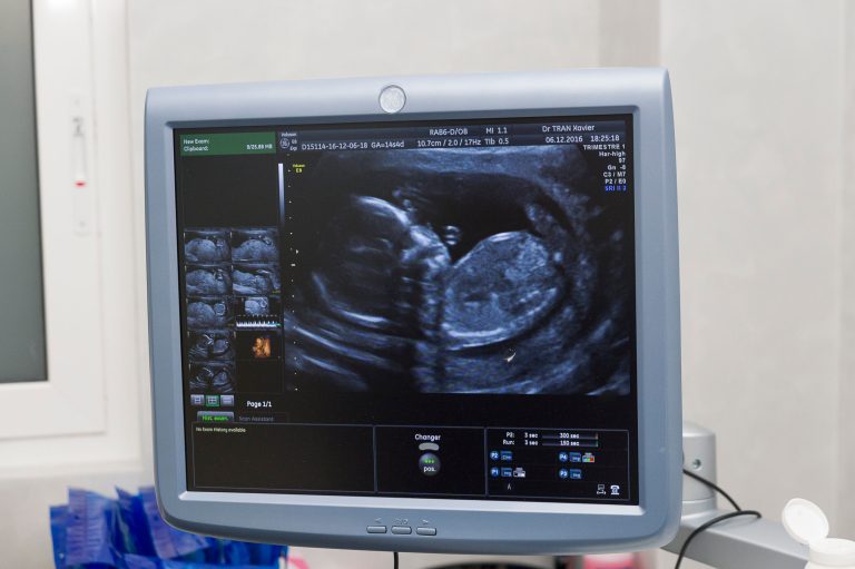 Scott Walker’s Dem Opponent: Tax Dollars Should Pay for Abortions Just Like They Pay for Tonsillectomies