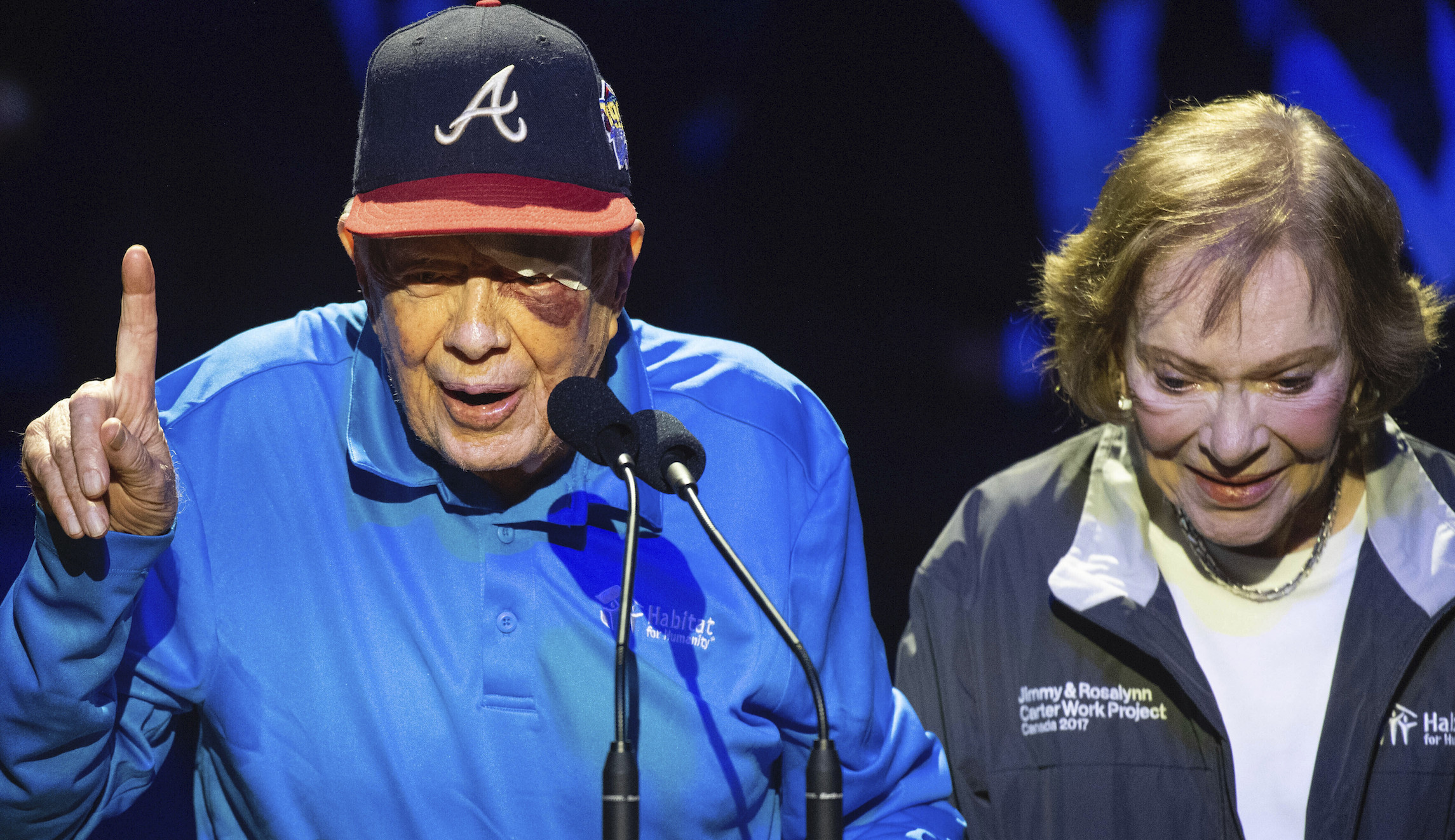 Jimmy Carter appears at charity event with black eye after fall in home