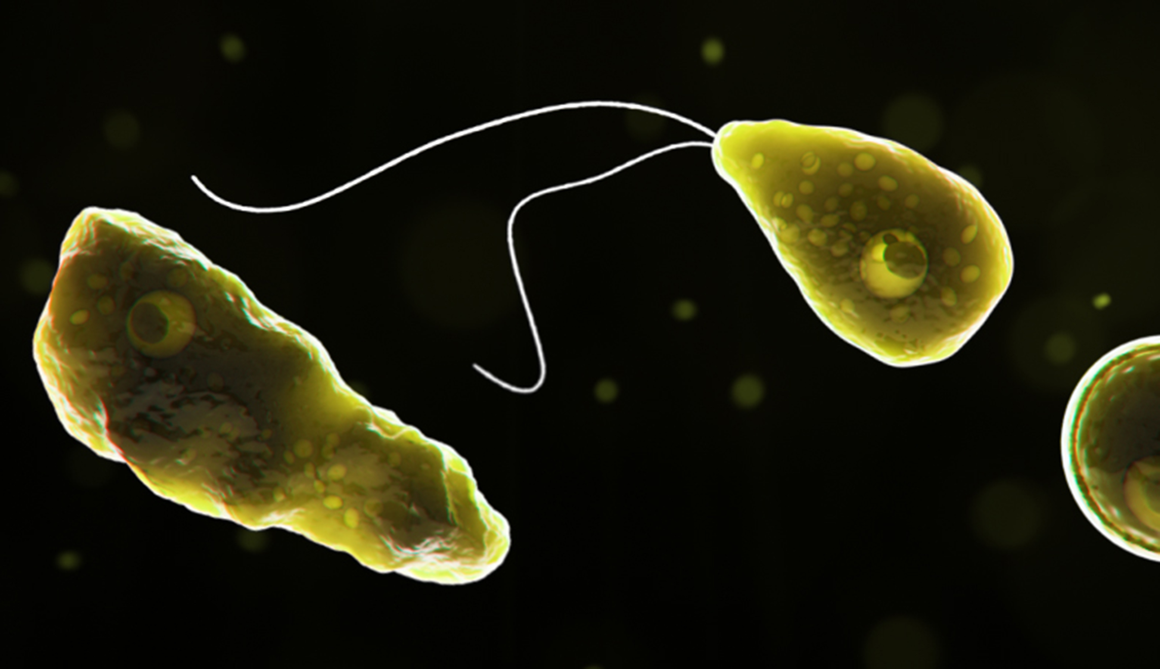 Man killed by rare brain-eating amoeba