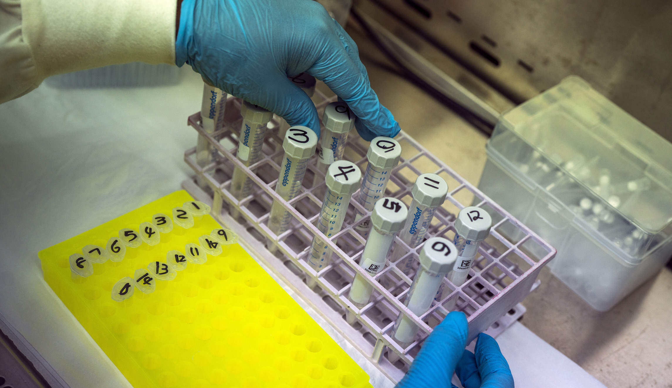 CDC to begin publishing wastewater surveillance data for COVID-19