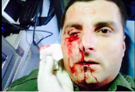 Fact Check: Does a Photo Show a Border Agent Attacked by the Current Migrant Caravan?