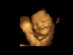 Kale no: Babies in womb indicate vegetable preferences with facial cues, study says