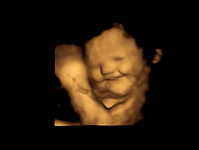 Kale no: Babies in womb indicate vegetable preferences with facial cues, study says