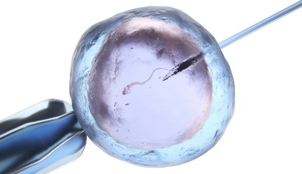 Alabama’s IVF reality and its far-reaching impacts: Everything you need to know