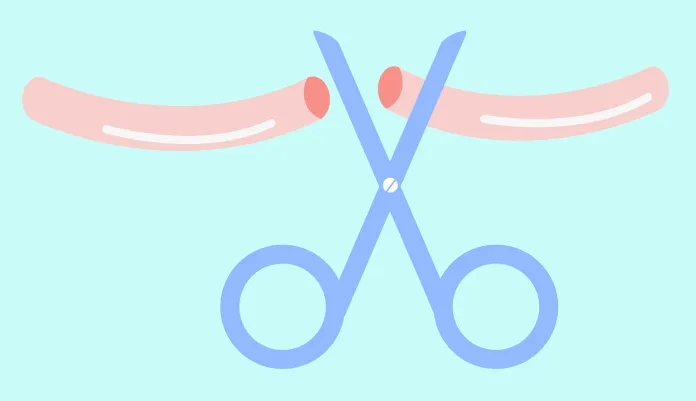 Want to support women? Get a vasectomy