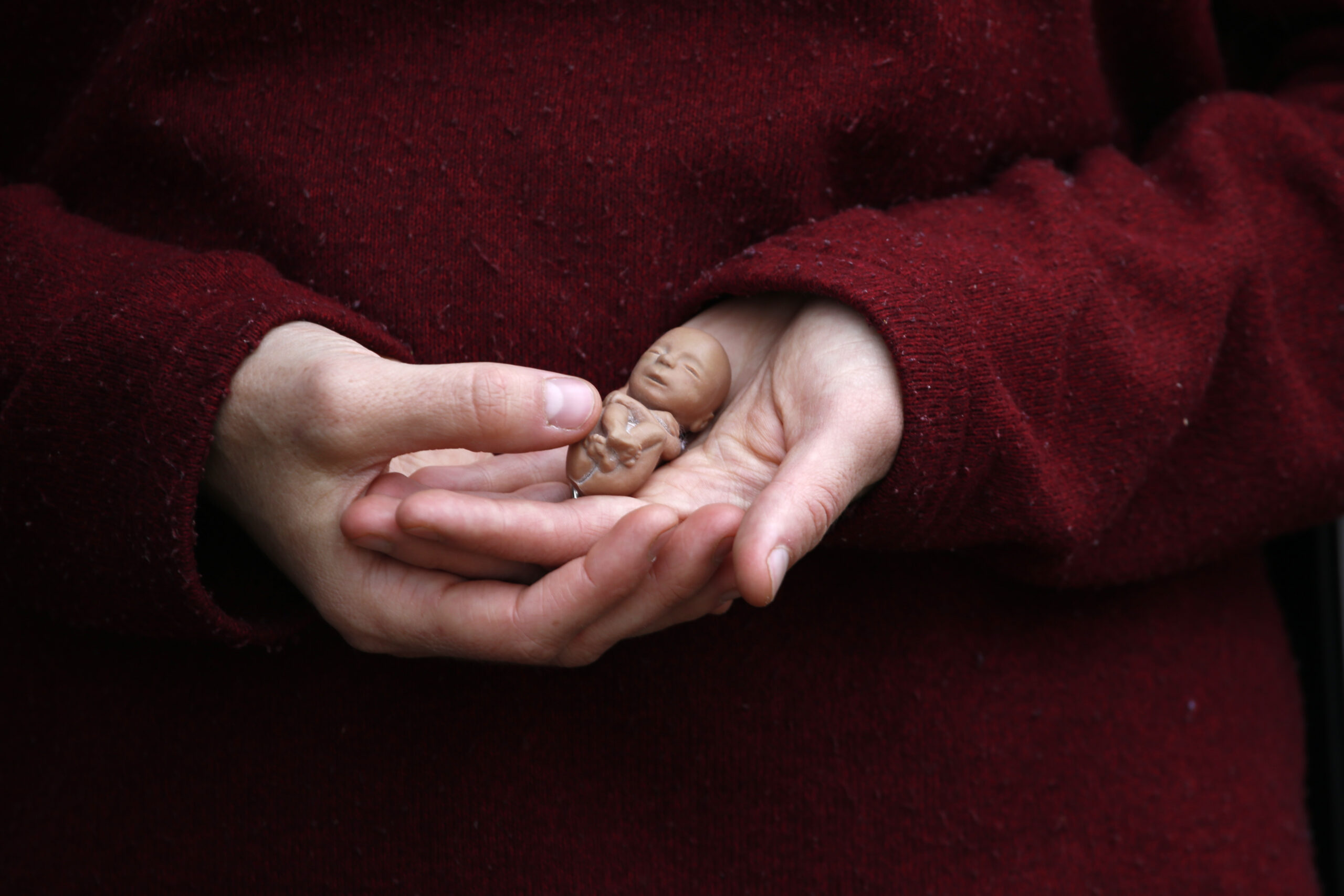 Fetal personhood is the next legal front line for the anti-abortion movement