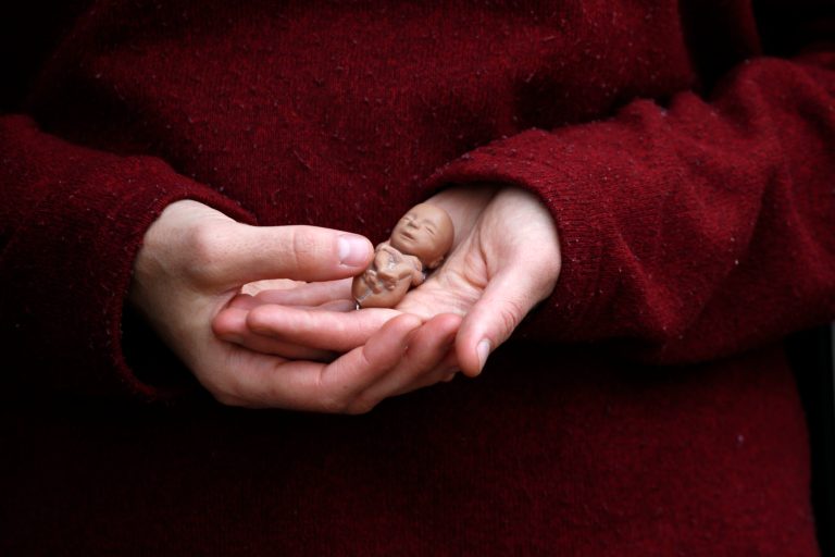 Fetal personhood is the next legal front line for the anti-abortion movement