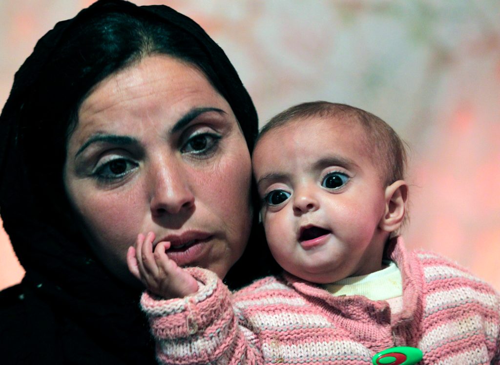 Malnutrition grows among Syrian refugee children