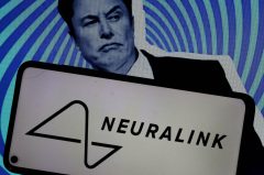 Are Elon Musk’s brain implants really worth it?