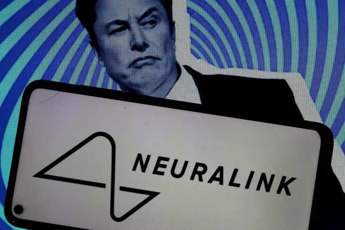 Are Elon Musk’s brain implants really worth it?