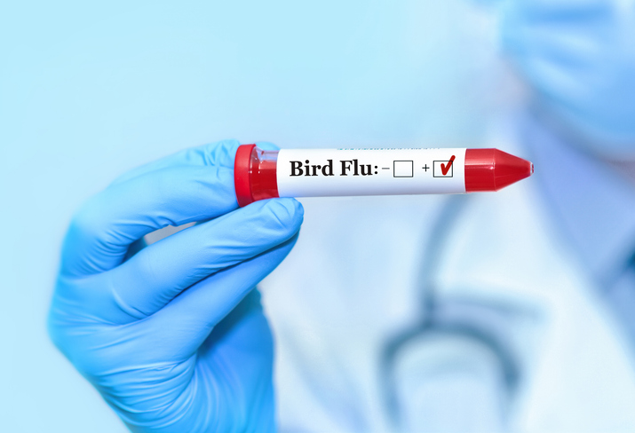 Nevada health district confirms state’s first human case of bird flu