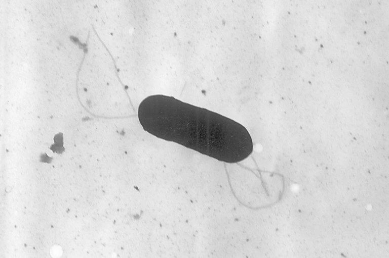 Here’s what to do with deli meats as the CDC investigates a listeria outbreak across the U.S.