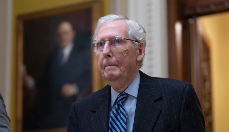 Senate Minority Leader Mitch McConnell (R-KY) is seen with a bandaged face and wrist brace following a stumble and fall earlier at lunch at the Capitol in Washington, Tuesday, Dec. 10, 2024.