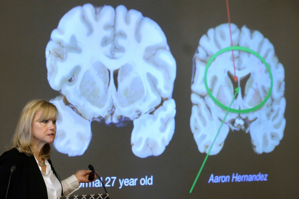 NextImg:Shooter who targeted NFL headquarters diagnosed with CTE after death