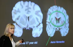 We keep finding CTE in young brains, but sending them back on the field anyway