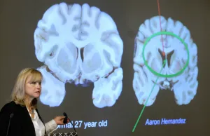 We keep finding CTE in young brains, but sending them back on the field anyway
