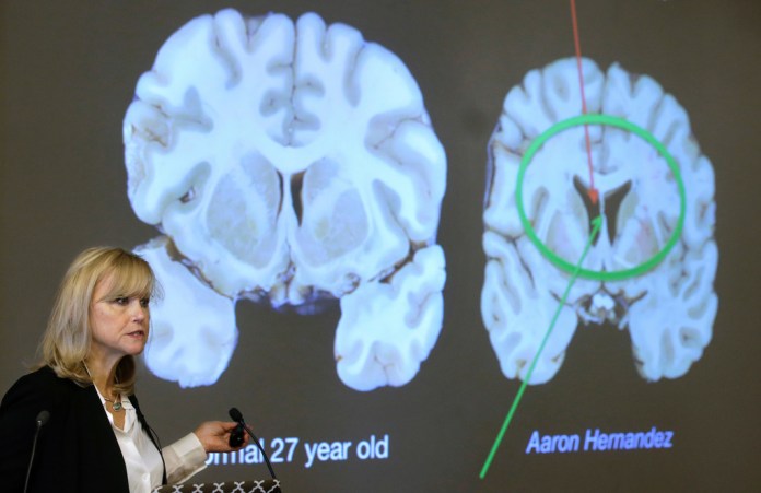 Shooter who targeted NFL headquarters diagnosed with CTE after death
