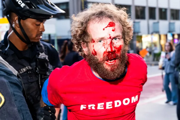 A bloodied man who was distributing "Freedom" shirts is detained following a scuffle with a protester outside a Turning Point USA event at the University of California, Berkeley on Monday, Nov. 10, 2025, in Berkeley, Calif. (AP Photo/Noah Berger)