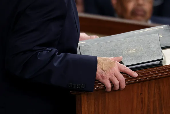 Trump’s bruised hand seen during State of the Union