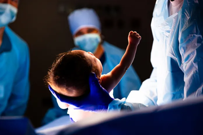 Baby delivered and raising arm and fist during C Section procedure in Hospital Operating Room birth rate babies children pro-life