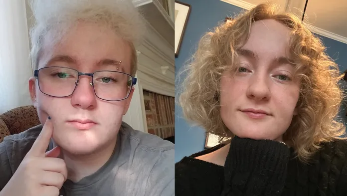 woman's before and after photo