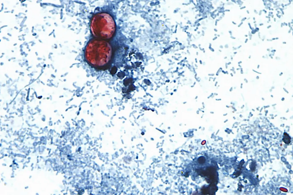 CDC adds four more states to cyclosporiasis outbreak investigation