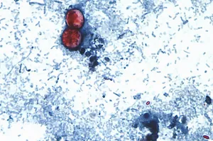 Two deaths in Michigan linked to cyclosporiasis outbreak